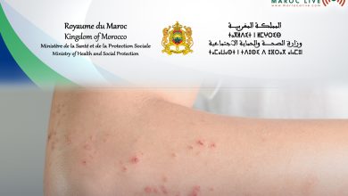 صورة وزارة الصحة والحماية الاجتماعية تعلن عن ارتفاع حالات الحصبة بالمغرب